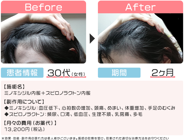 症例写真1
