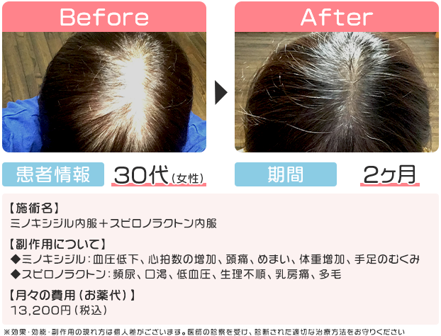 症例写真2