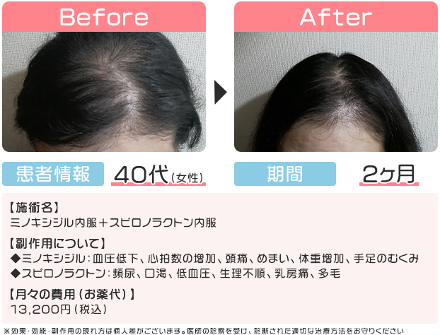 症例写真3